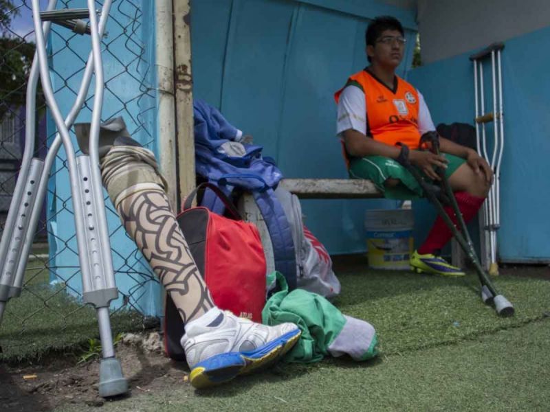 UNAM busca terapia física que evite problemas de lumbalgia por uso de prótesis